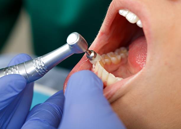 Best Periodontal (Gum) Disease Treatment  in Moss Beach, CA